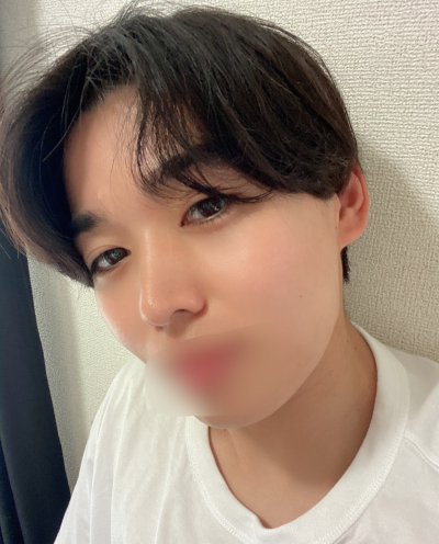 7613